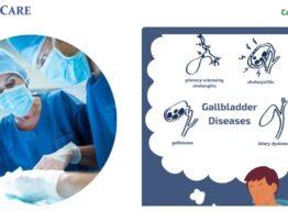 Gall Bladder Surgery in Noida